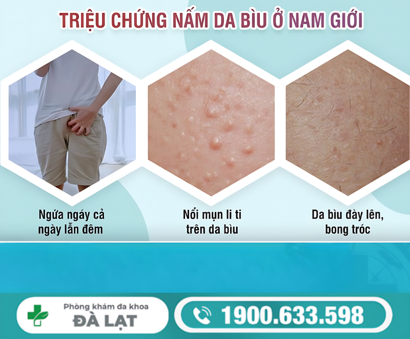 Hình ảnh minh họa